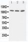 Anti-Zonula Occludens Protein 3 Antibody