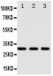 Anti-DR4 Antibody