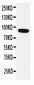 Anti-VRL1 Antibody