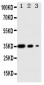 Anti-Wnt2b Antibody