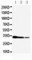 Anti-TORC2 Antibody