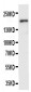 Anti-VEGFR2/KDR Antibody