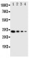 Anti-LTK Antibody