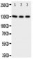 Anti-TrkC Antibody