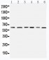 Anti-Mitochondrial Pyruvate Dehydrogenase Kinase 1 Antibody