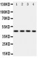 Anti-PDK2 Antibody