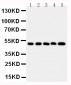 Anti-SPHK1 Antibody