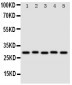 Anti-Stanniocalcin 1/STC1 Antibody