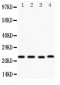 Anti-Stanniocalcin 2 Antibody