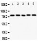 Anti-Tec Antibody