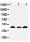 Anti-Tollip Antibody