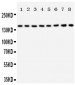 Anti-Hamartin Antibody