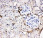 Anti-Adiponectin Antibody