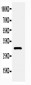 Anti-Adiponectin Antibody