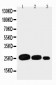 Anti-Adiponectin Antibody