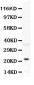 Anti-Bid Antibody