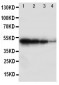 Anti-BMPR1B Antibody