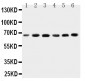 Anti-CETP Antibody