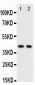 Anti-CXCR5 Antibody