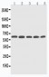 Anti-CYP2U1 Antibody