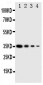 Anti-PKR Antibody