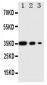 Anti-PERK Antibody