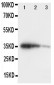 Anti-GCN2 Antibody