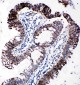 Anti-EIF2S1 Antibody