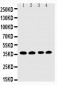 Anti-EIF2S1 Antibody