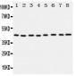 Anti-PGK1 Antibody