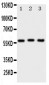 Anti-PKM2 Antibody