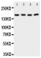 Anti-PLA2G4A Antibody