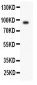 Anti-Periostin/OSF2 Antibody