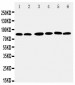 Anti-RSK1 p90 Antibody