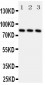 Anti-RSK1 p90 Antibody