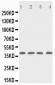 Anti-p53R2 Antibody
