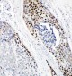 Anti-p63 Antibody