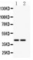 Anti-CD244/2B4 Antibody