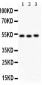 Anti-Factor VII Antibody