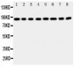 Anti-Factor VIII Antibody