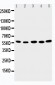 Anti-ABI2 Antibody