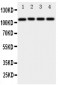 Anti-ADAM19 Antibody