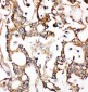 Anti-ALDH2 Antibody