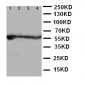 Anti-ALDH2 Antibody