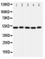 Anti-ALDH3A1 Antibody
