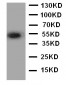 Anti-ANGPTL3 Antibody