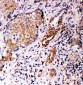 Anti-Annexin A10 Antibody