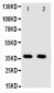 Anti-Annexin A10 Antibody