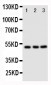 Anti-CXCR4 Antibody