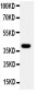 Anti-MADCAM-1 Antibody